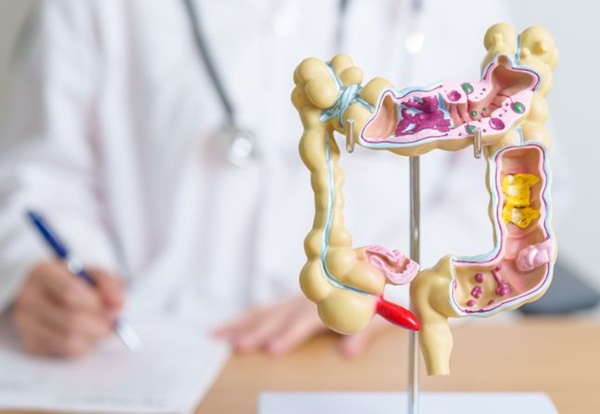 maladie-crohn-systeme-digestif-causes